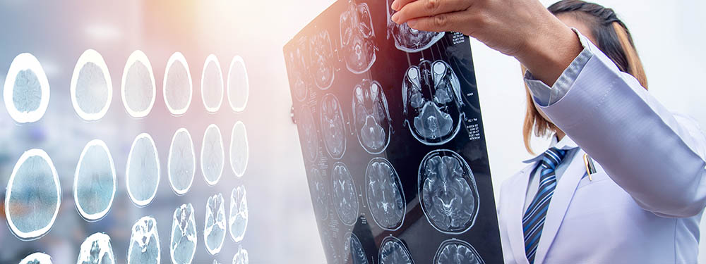 Diagnose eines Schädelhirntraumas Diagnose eines Schädelhirntraumas