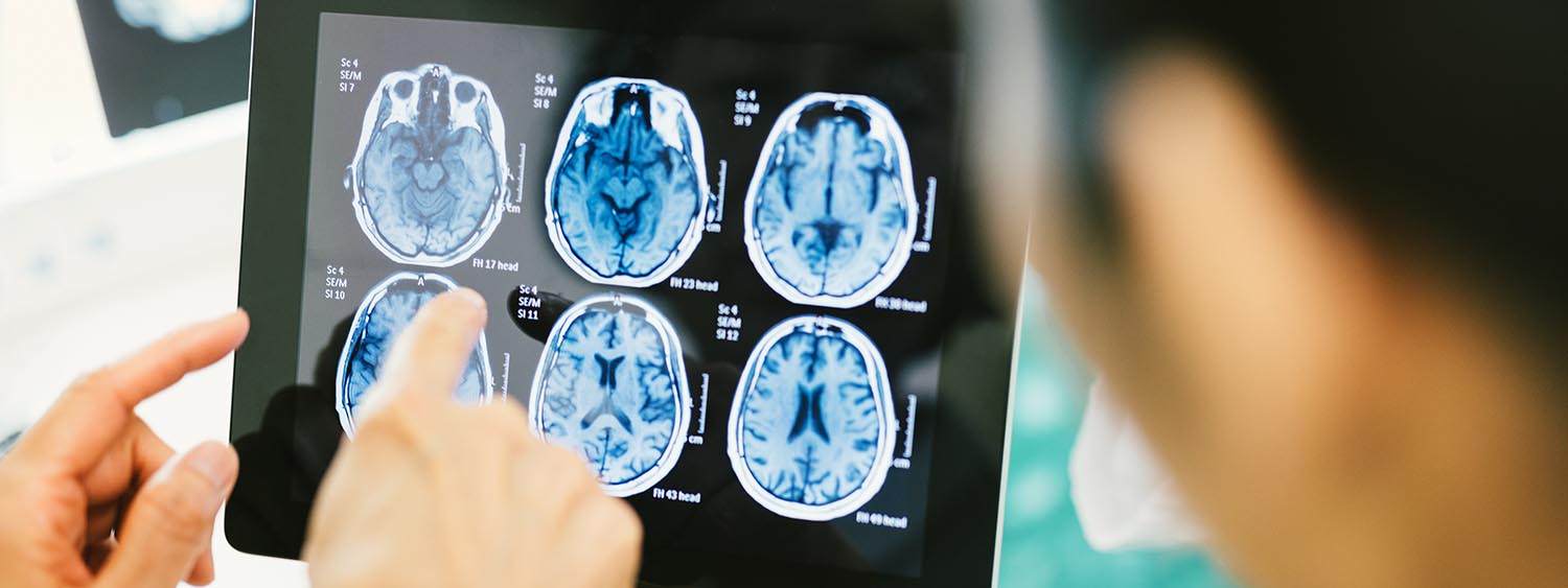 Diagnosis of infantile cerebral palsy Diagnosis of infantile cerebral palsy