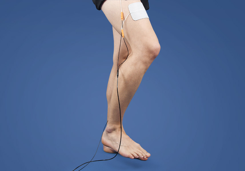Functional electrical stimulation for the treatment of ataxia Functional electrical stimulation for the treatment of ataxia