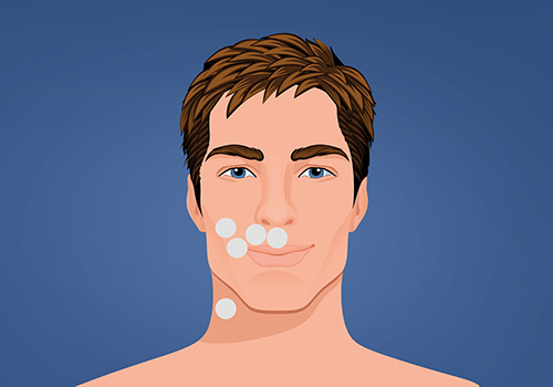 STIWELL therapy | activation of mouth movement STIWELL therapy | activation of mouth movement