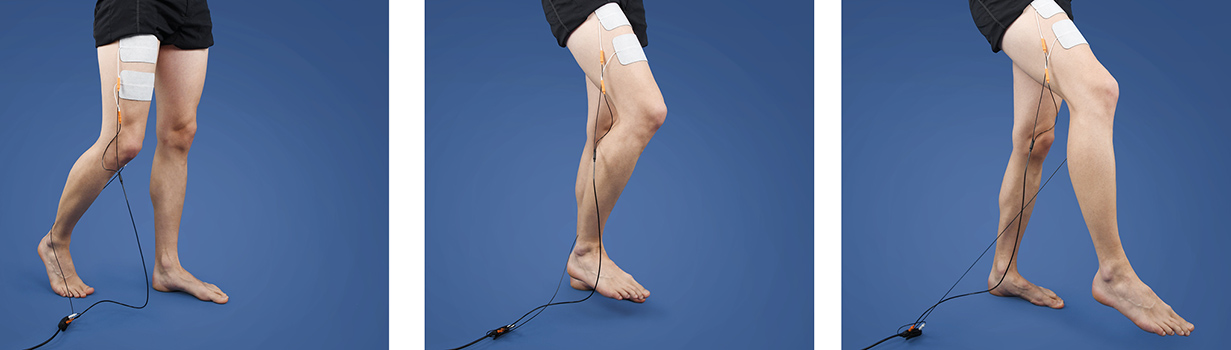 Cruciate ligament rupture: healing time and process Cruciate ligament rupture: healing time and process