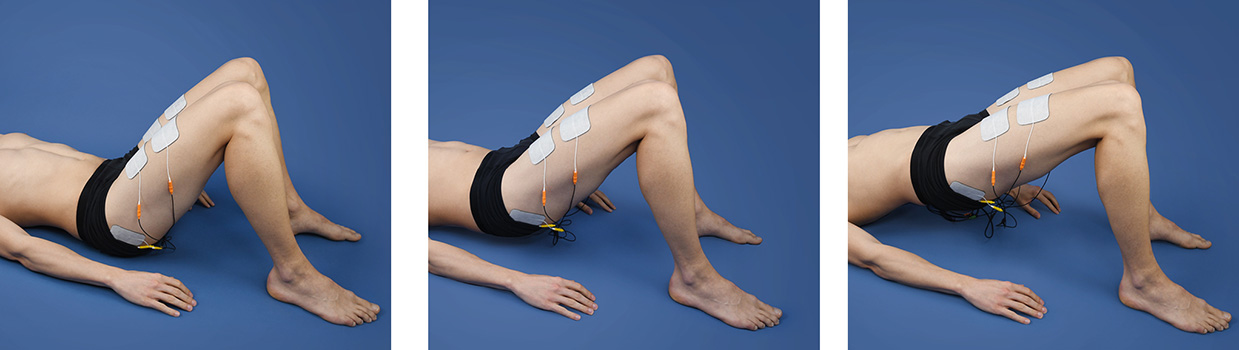 Rehabilitation bei einer Hüftarthrose Rehabilitation bei einer Hüftarthrose