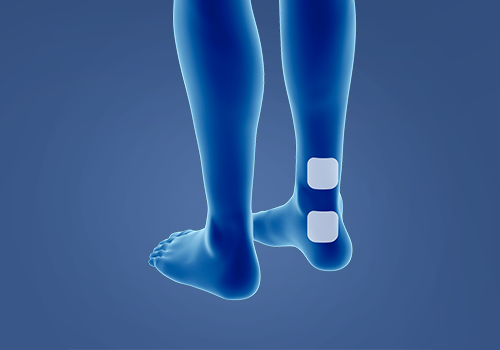 STIWELL Therapie | Überaktive Blase STIWELL Therapie | Überaktive Blase