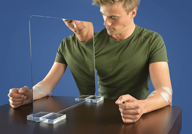 Electrical stimulation to reduce pain in patients with CRPS Electrical stimulation to reduce pain in patients with CRPS