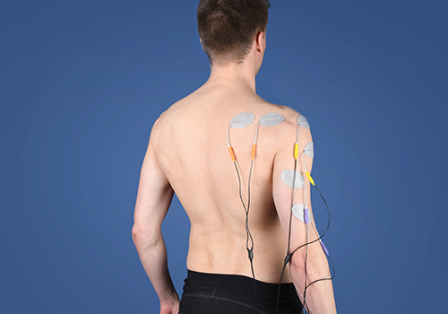 STIWELL Therapie | Plexus brachialis Läsion STIWELL Therapie | brachialis Läsion
