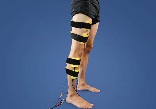 STIWELL Therapie | Plexus lumbosacralis Parese STIWELL Therapie | Plexus lumbosacralis Parese