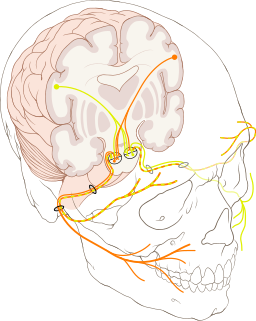 Forms of facial paralysis Forms of facial paralysis