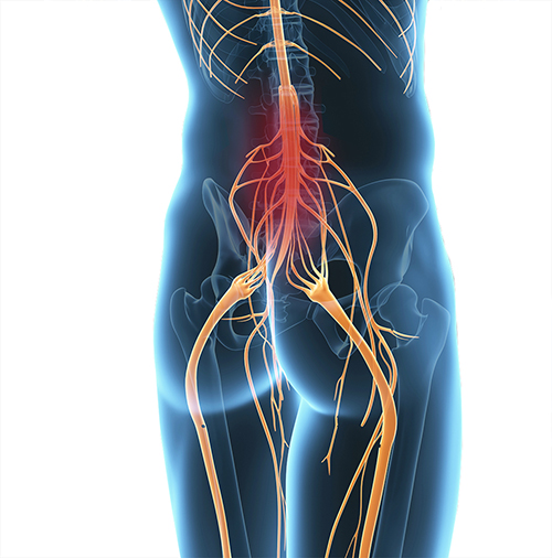 Symptoms of tetraplegia Symptoms of tetraplegia